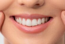 How many teeth does a human have?