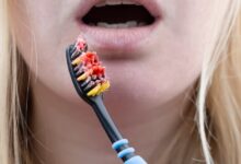 Why do my gums bleed when I brush