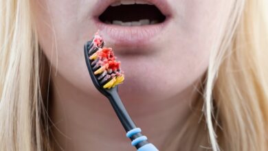 Why do my gums bleed when I brush
